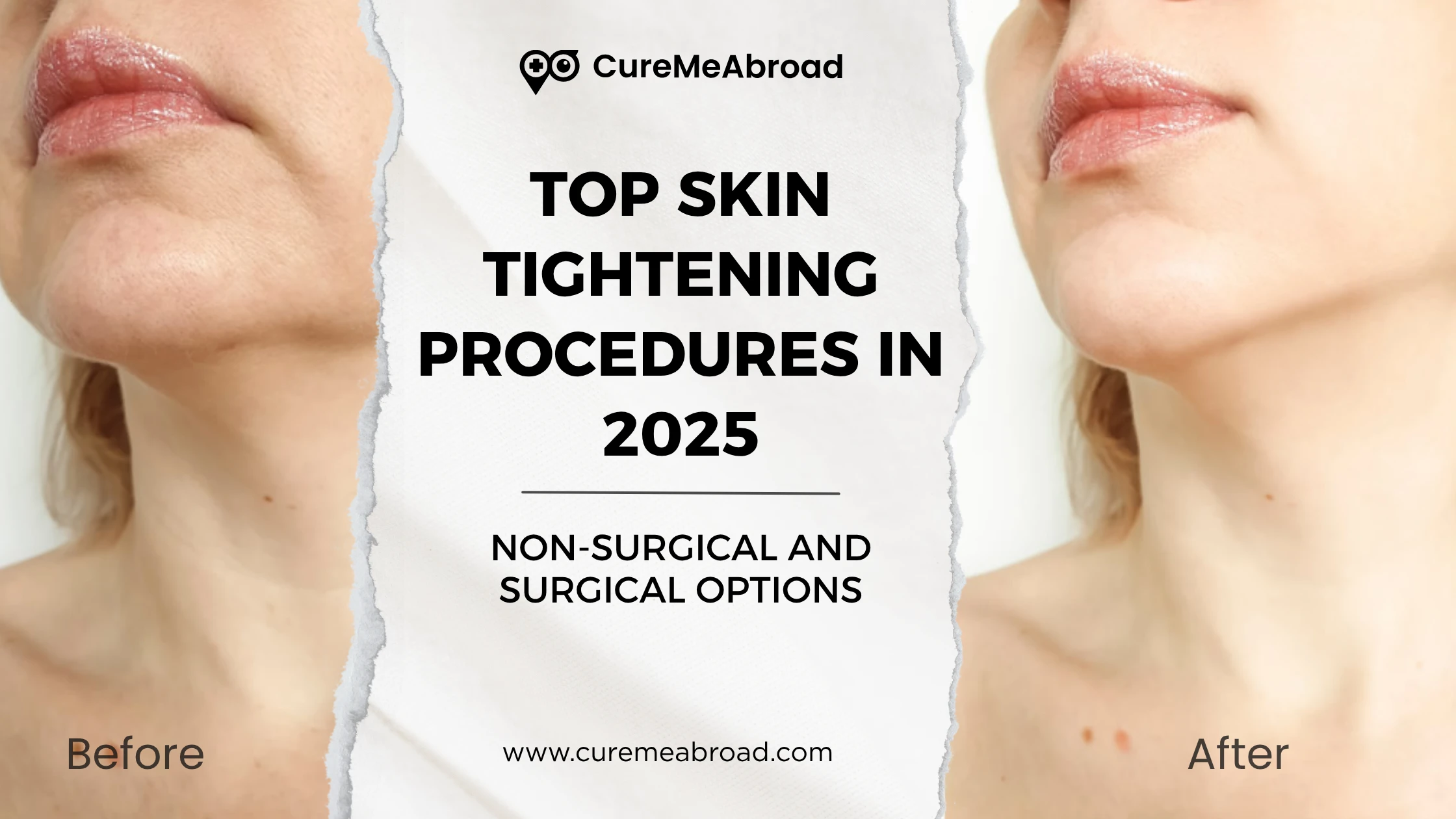 Top Skin Tightening Procedures in 2025: Non-Surgical and Surgical Options  