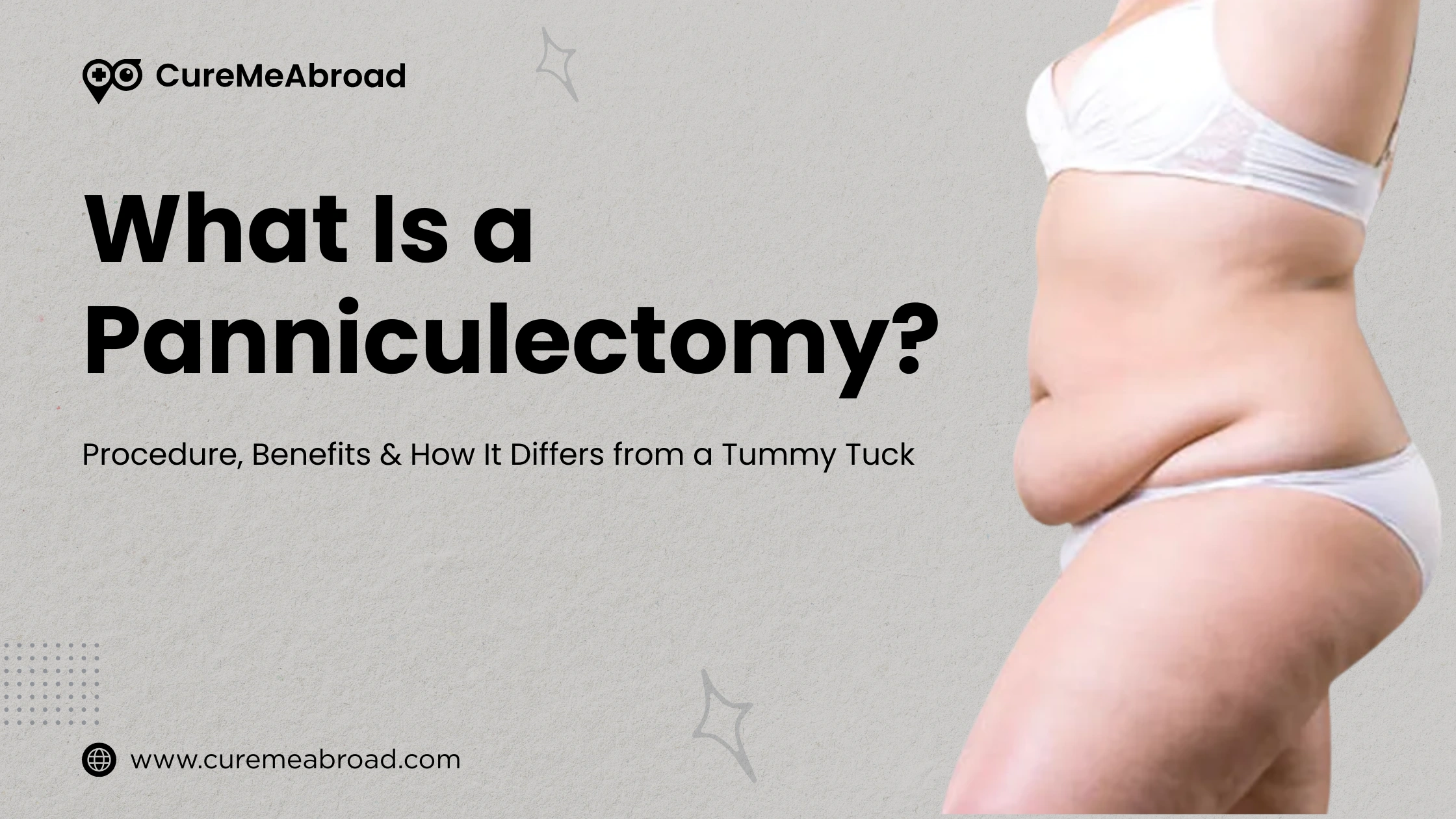 What Is a Panniculectomy? Procedure, Benefits & How It Differs from a Tummy Tuck