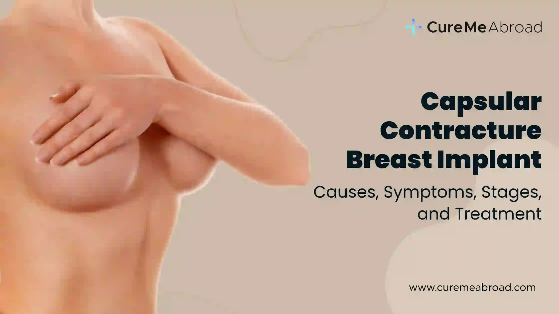 Capsular Contracture Breast Implant: Causes, Symptoms, Stages, and Treatment