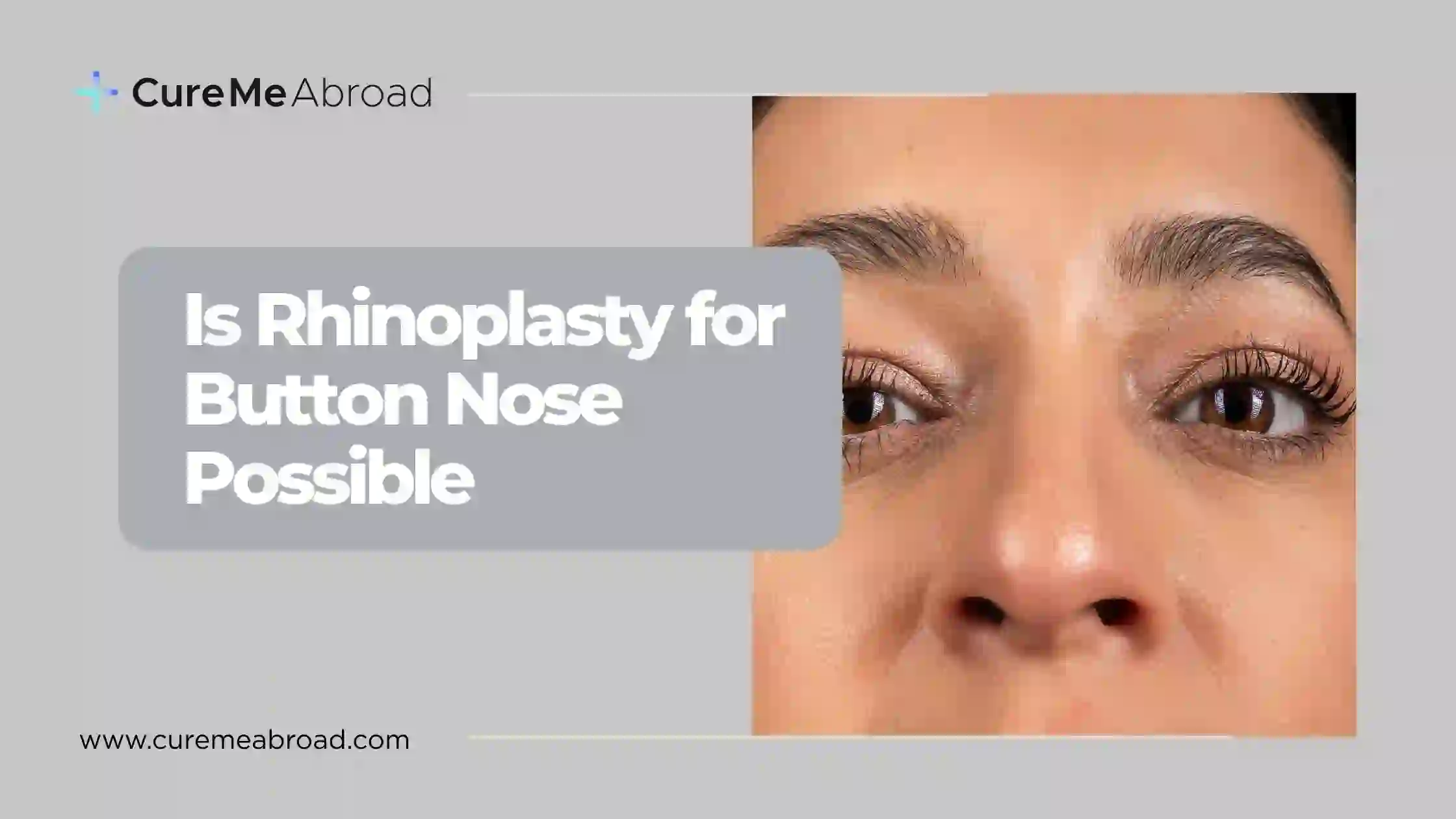 Is Rhinoplasty for Button Nose Possible?