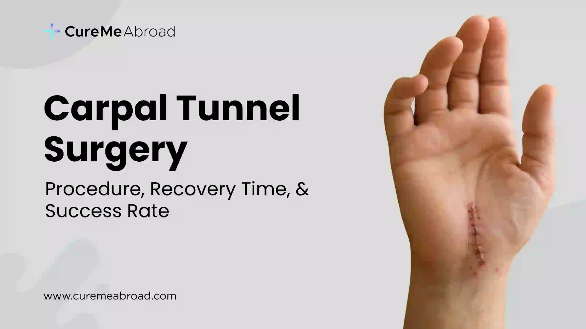 Carpal Tunnel Surgery: Procedure, Recovery Time, & Success Rate
