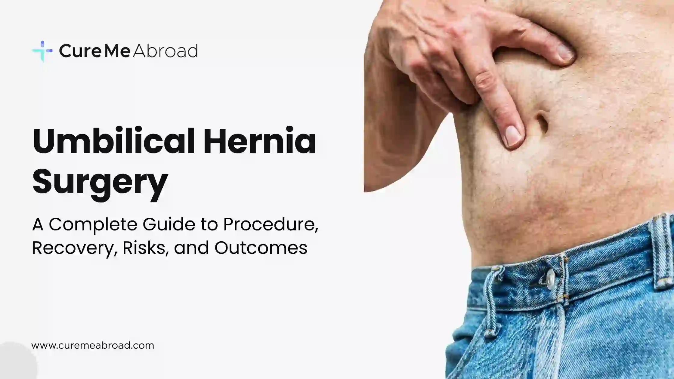 Umbilical Hernia Surgery: A Complete Guide to Procedure, Recovery, Risks, and Outcomes