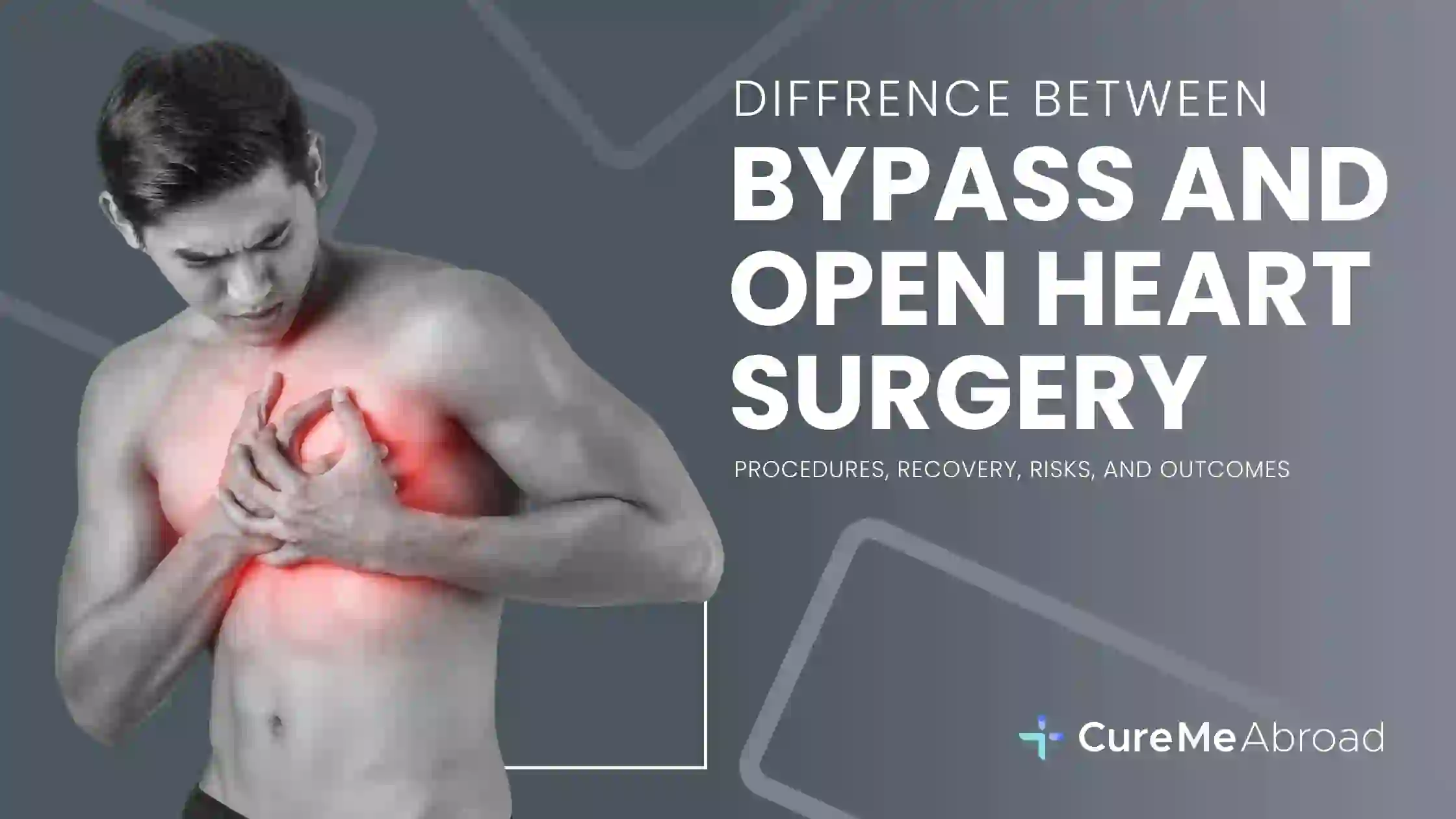 Difference Between Bypass and Open Heart Surgery: Procedures, Recovery, Risks, and Outcomes