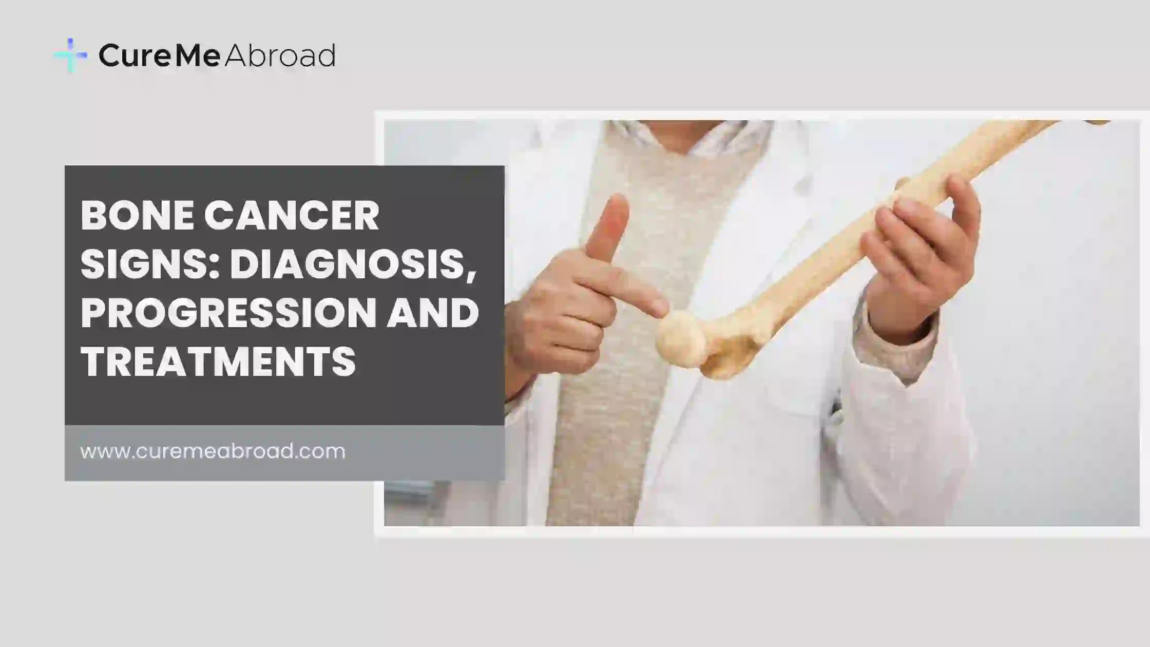 Bone Cancer Signs: Diagnosis, Progression, and Treatments