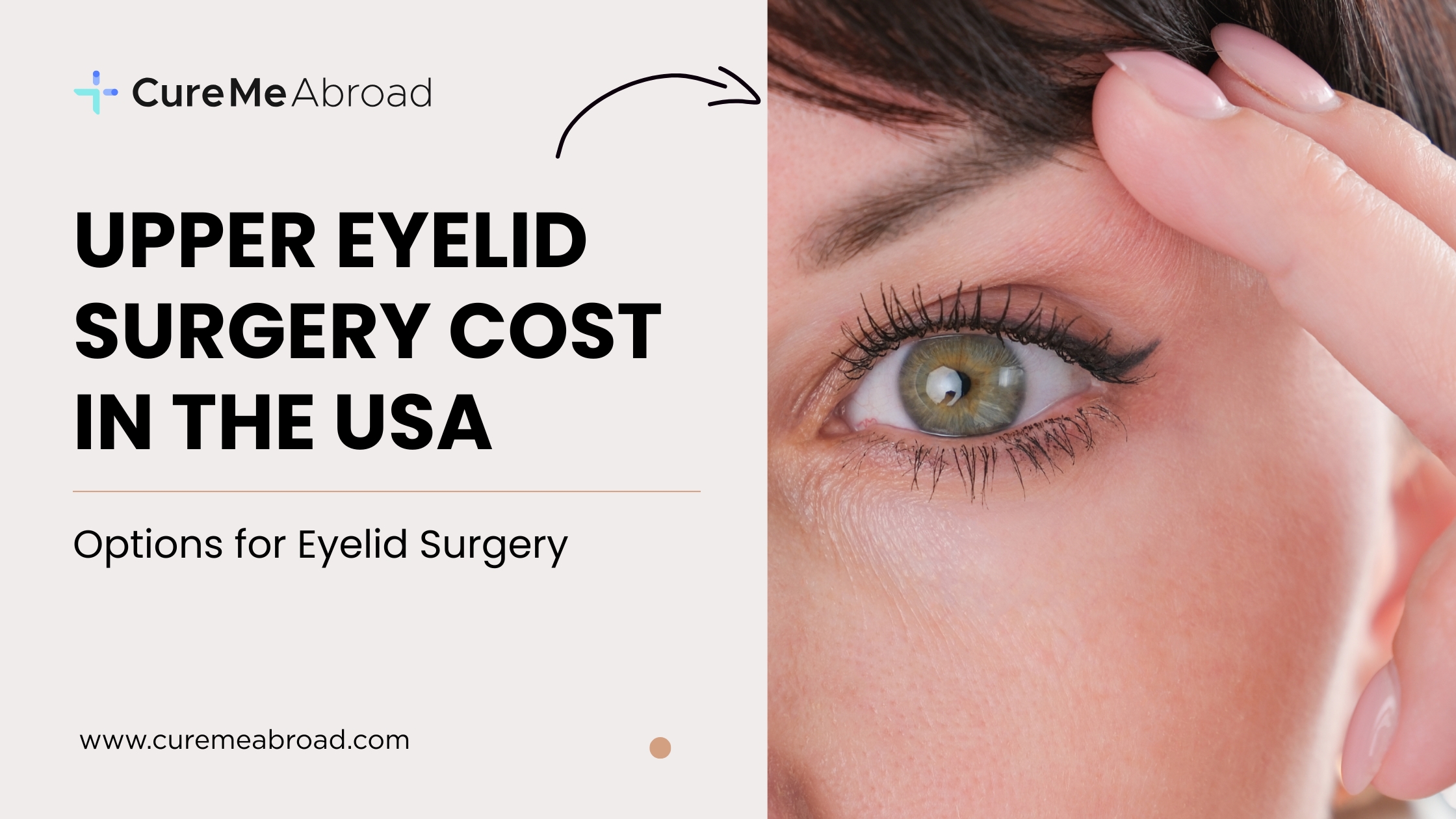 Upper Eyelid Surgery Cost in the USA: Options for Eyelid Surgery