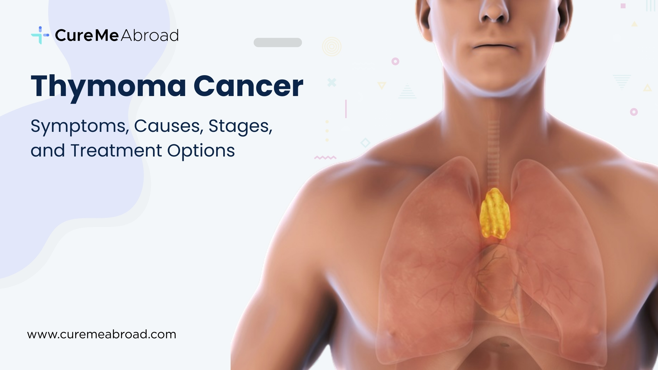 Thymoma Cancer: Symptoms, Causes, Stages, and Treatment Options