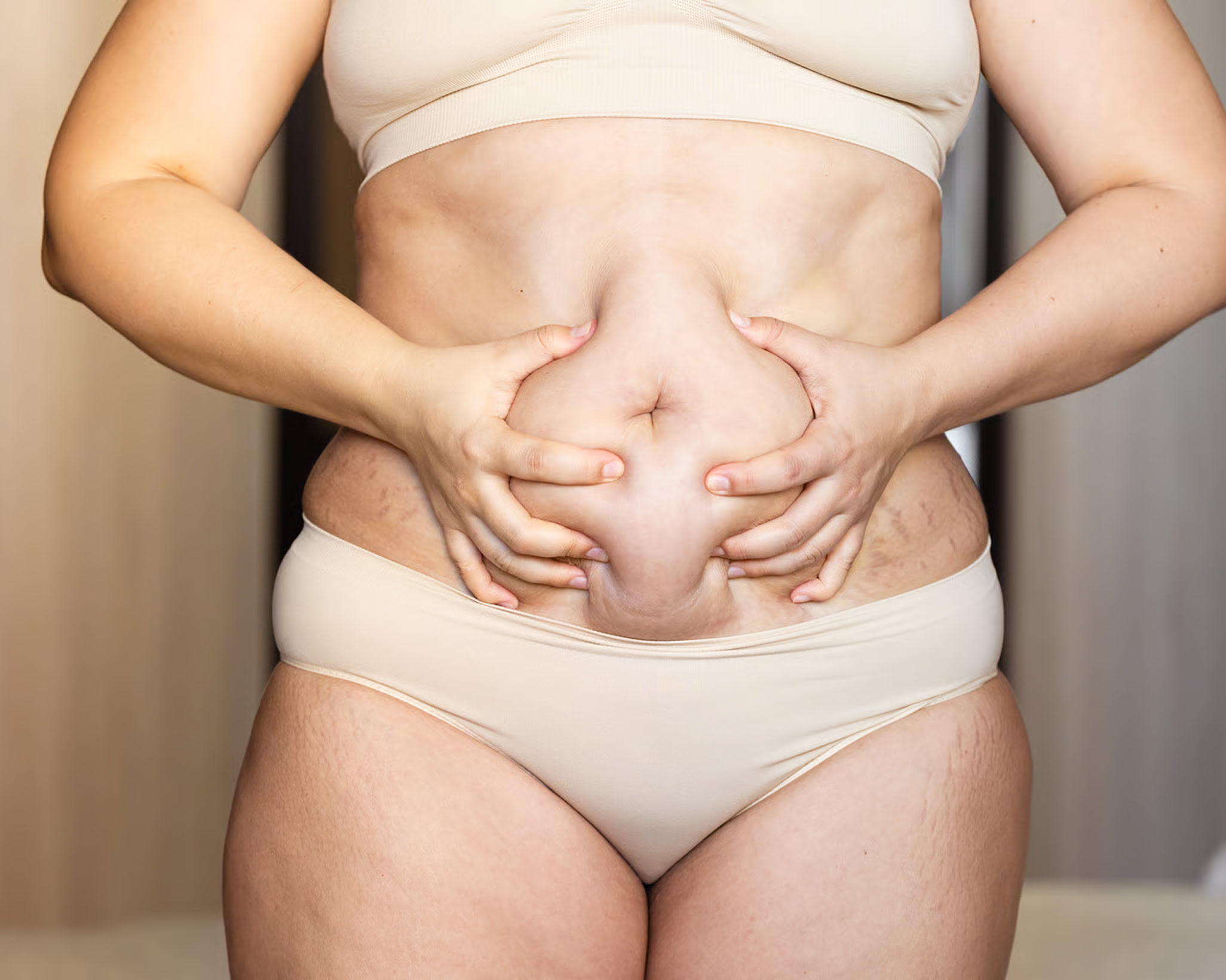 5. Plus Size Tummy Tuck  Safety, (1)