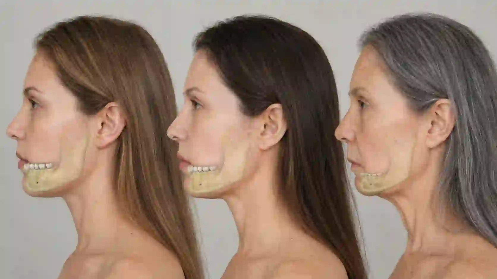 Facial Changes and Premature Aging after tooth losscompressed 