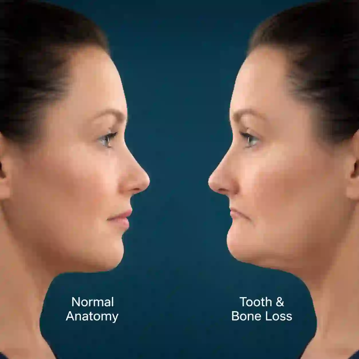 facial changes after loosing teeth and make it looks like older