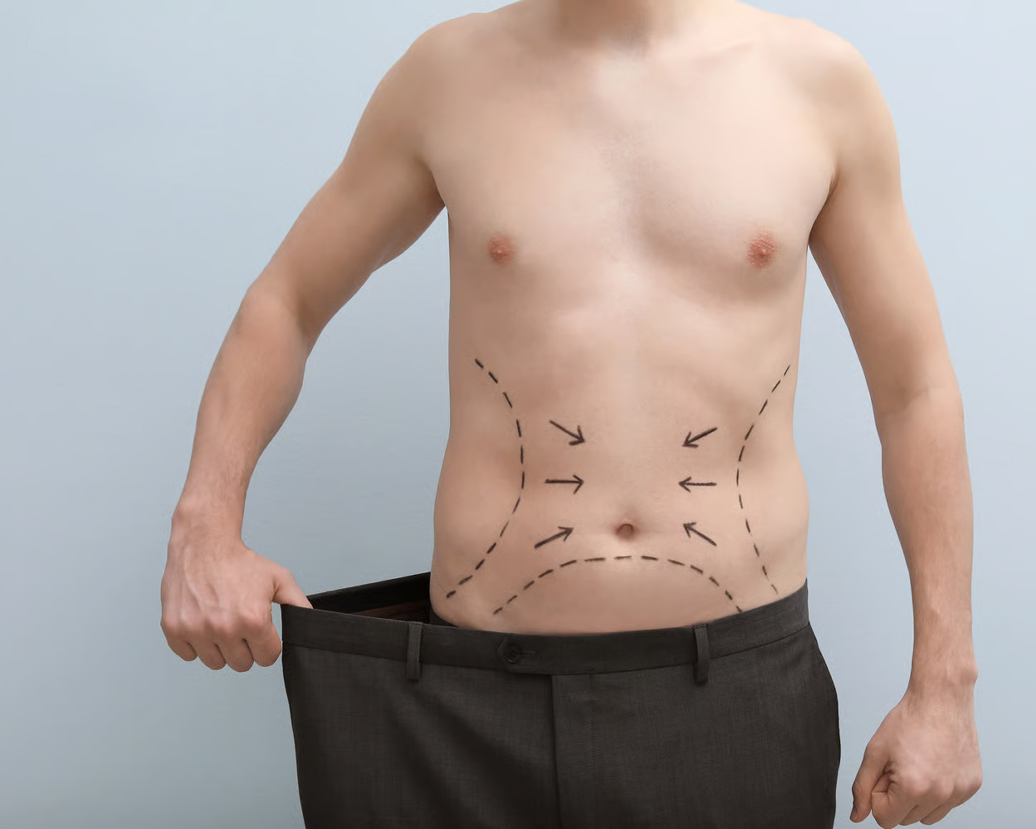 6. Male Tummy Tuck Cost, Proced (1)