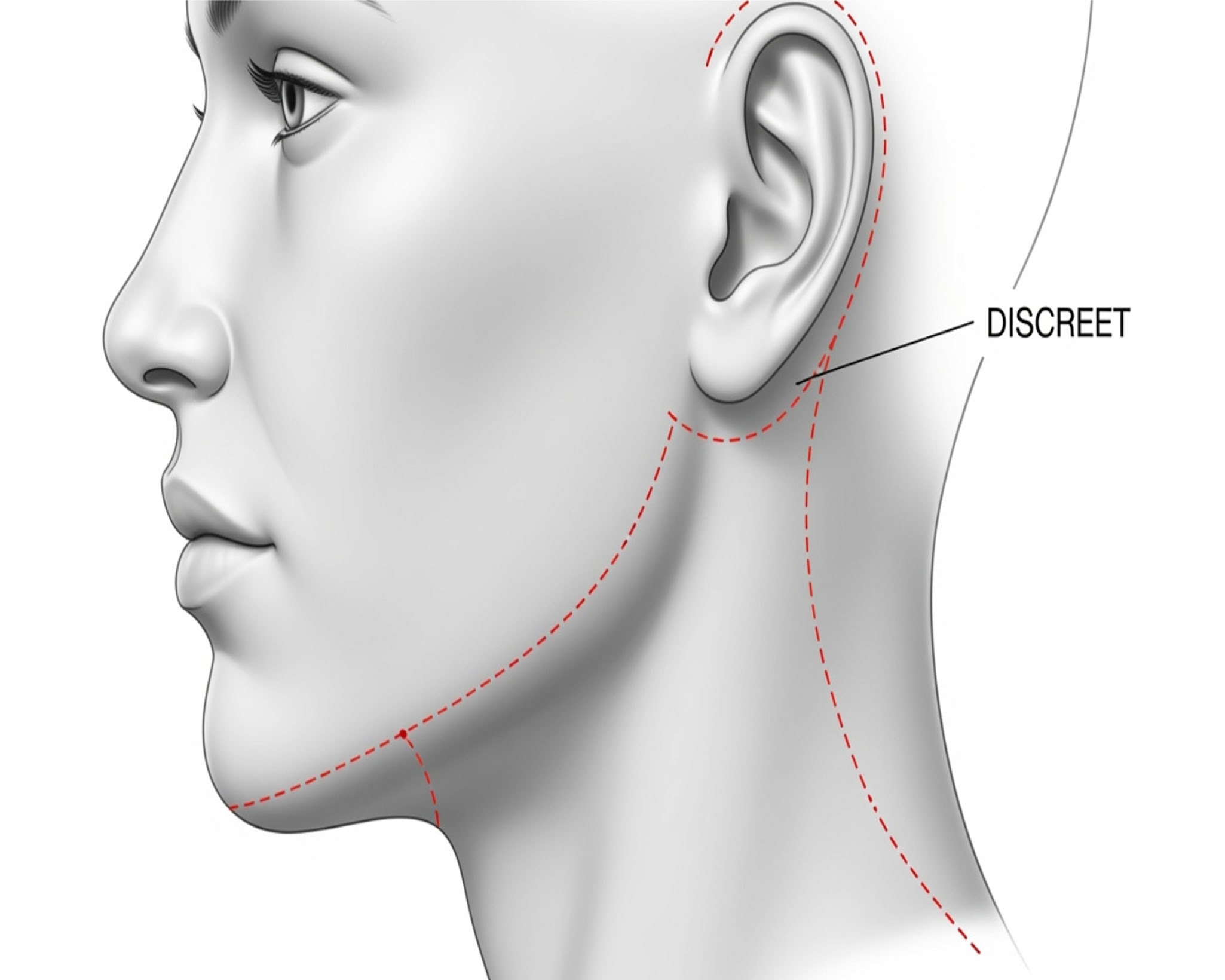 10. How Much Does a Neck Lift Co