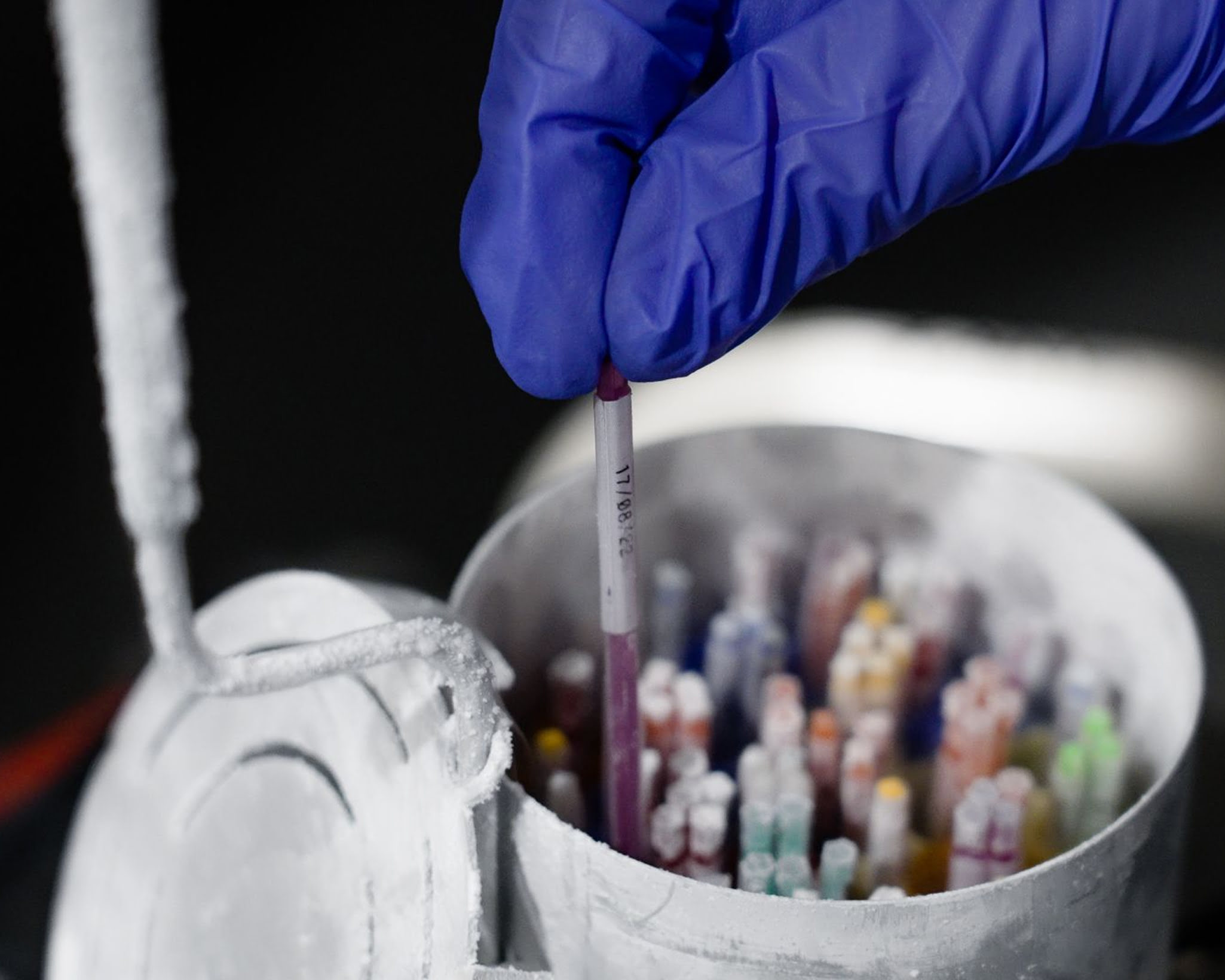 Frozen Embryo Transfer Timeline