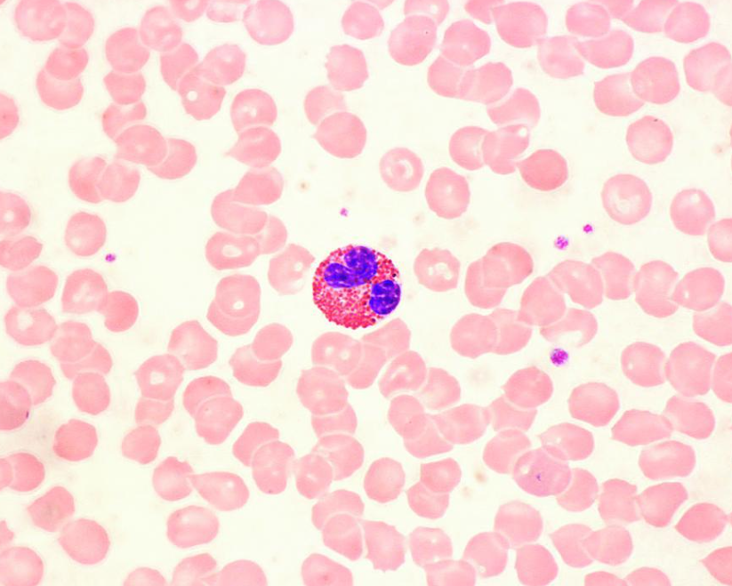 image of Eosinophils