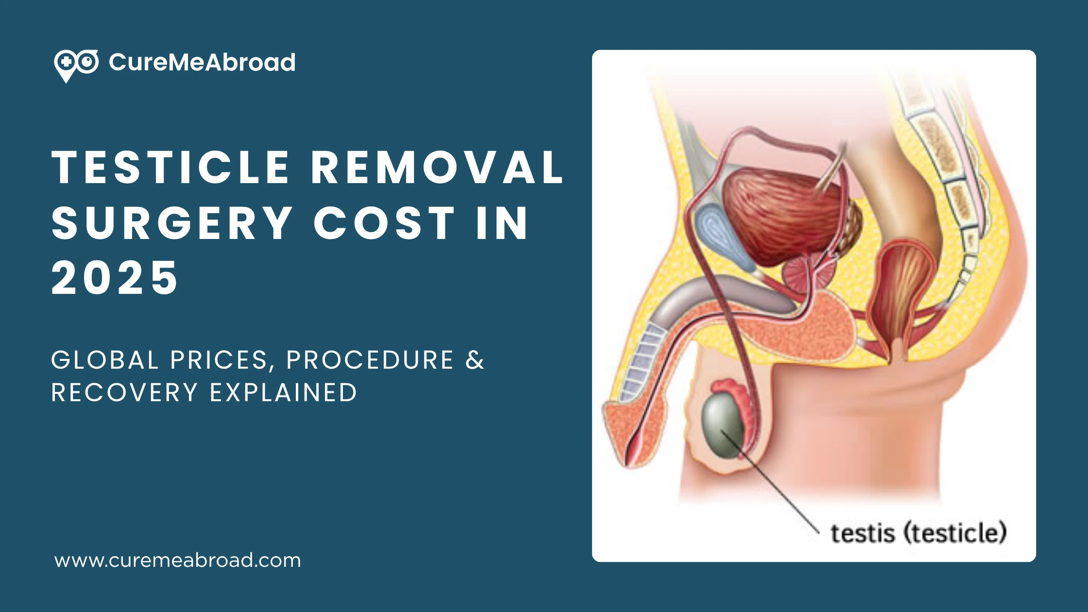Testicle Removal Surgery Cost in 2025: Global Prices, Procedure & Recovery Explained