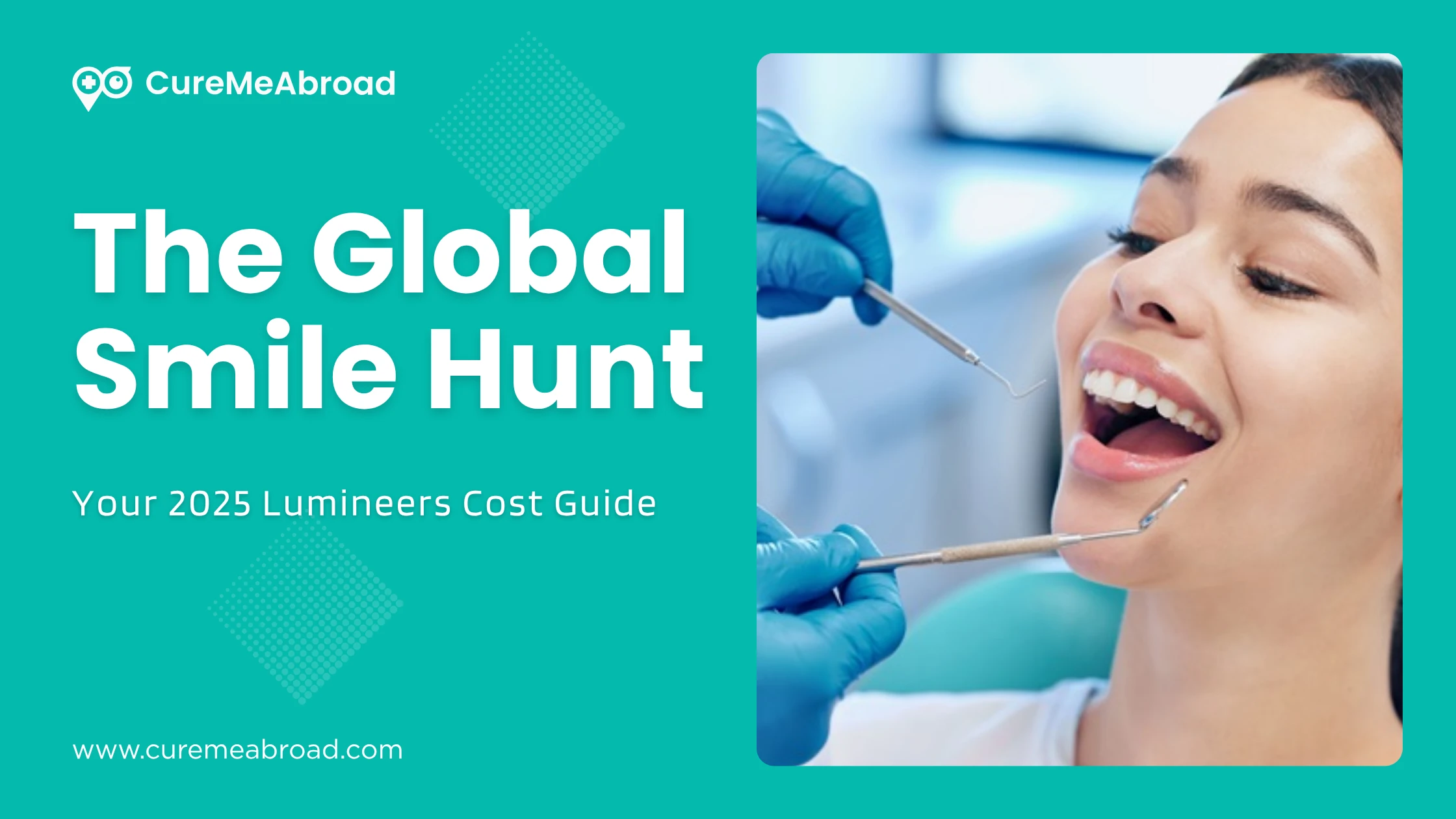 The Global Smile Hunt: Your 2025 Lumineers Cost Guide